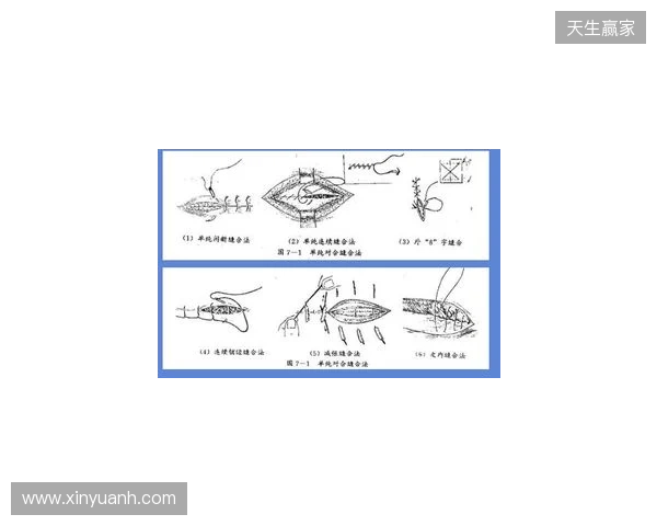 广州豹官方:杨浩眉弓伤口缝合30余针,预计5-7天后拆线